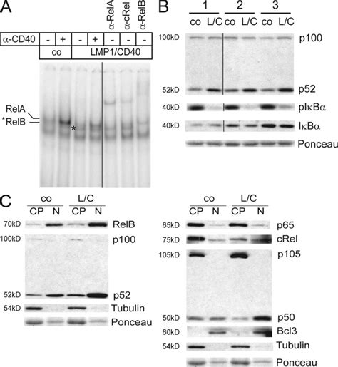 LMP1 CD40 expression induces activity of the noncanonical NF κB