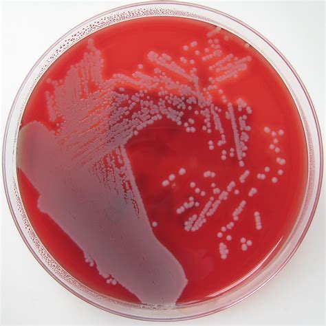 Importancia De La Detecci N De Samr Staphylococcus Aureus Meticilino