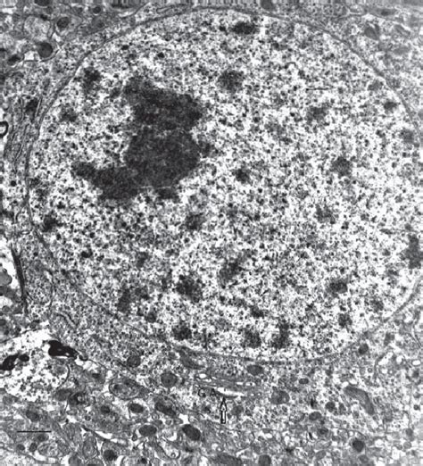 Purkinje Cell From The Inferior Semilunar Lobe Of The Cerebellar