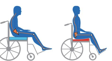 Module 2 Mobility And Immobility Flashcards Quizlet