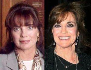 Linda Gray Plastic Surgery - With Before And After Photos