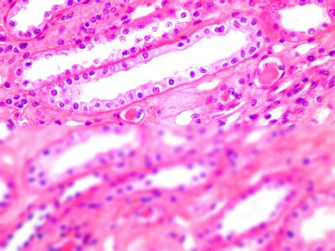 Solution Simple Cuboidal Epithelium Studypool