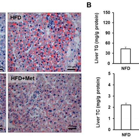 Adle Reduced Lipid Accumulation In The Liver Of Hfd Induced Diabetic