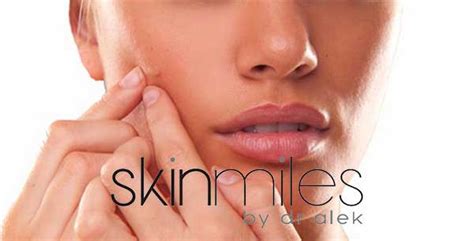 Acne Quick Guide Archives Skinmiles