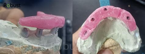 importance   fitting  bite  big dental cases robust