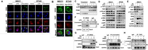 国自然热点细胞焦亡研究之 肿瘤抑制因子 DRD2 促进 M1 巨噬细胞并限制 NF κB 信号传导以触发乳腺癌中的焦磷酸化 企业动态