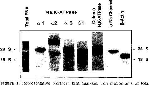 Figure From Differential Effects Of Glucocorticoids And