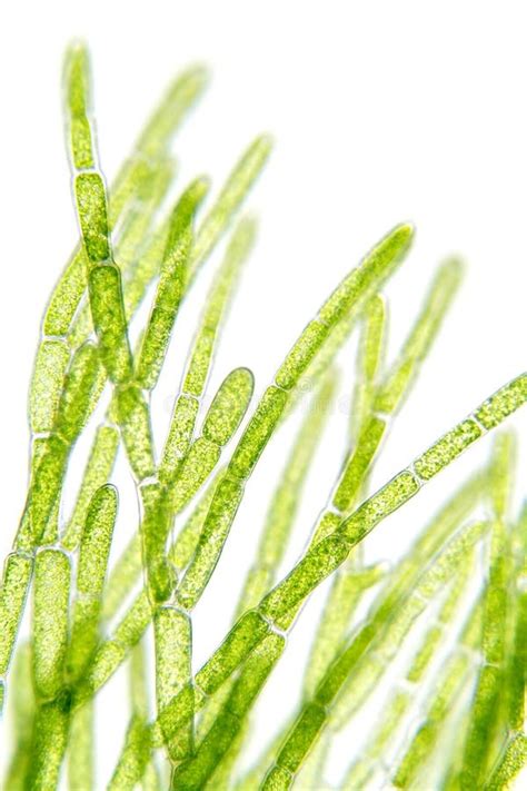 Algae Under Microscopic View Stock Photo - Image of plant, chlophyll ...