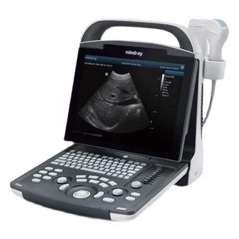 mindray ultrasound system sinocare medical technology coltd