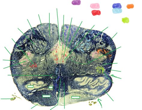 E3 Caudal Medulla Diagram Quizlet