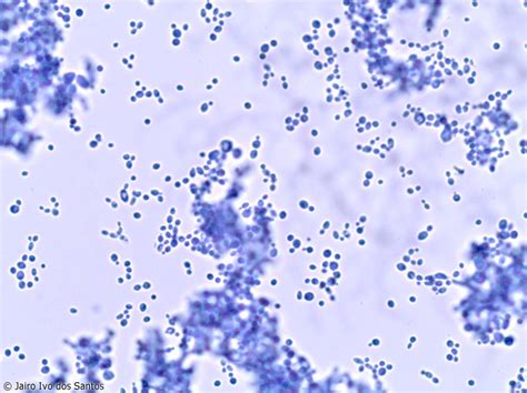 Candidíase Candida sp Micoses Doenças Infecciosas e Parasitárias