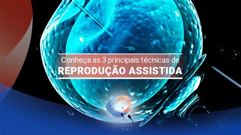 Reprodu O Assistida Conhe A As Principais T Cnicas Dr Augusto