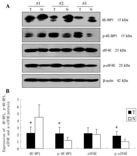 Putative Role Of The MTOR 4E BP1 Signaling Pathway In The