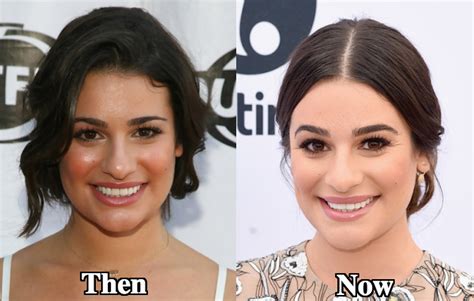 Lea Michele Nose Job Plastic Surgery Before and After Photos - Latest Plastic Surgery Gossip And ...