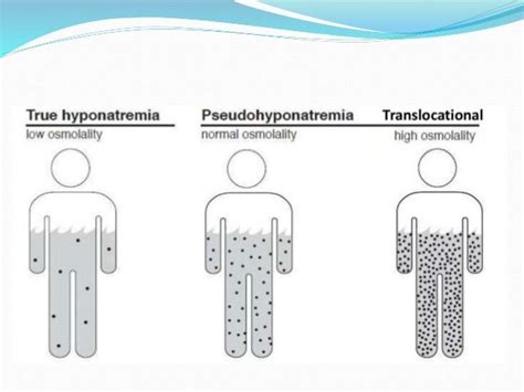 Neurology Of Electrolyte Imbalance