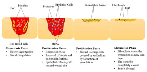 Granulation Tissue Wound