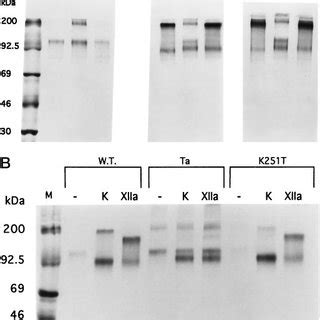 Sds Page Of Recombinant Wild Type W T Ta And Lys Thr K T