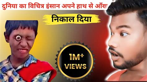 दुनिया का विचित्र इन्सान अपने हाथ से आँख निकाल दियाfunny Videos😂try