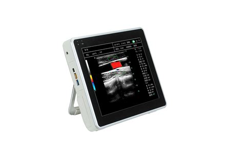 Color Doppler Ultrasound Portable