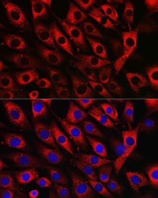 Ufl Antibody Nbp Novus Biologicals