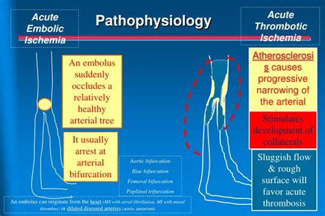 Ppt Peripheral Arterial Disease Pad Powerpoint Presentation Id