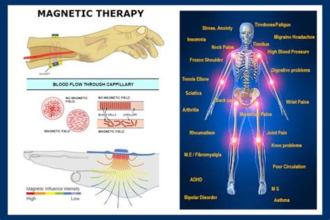 Magnetic Therapy | Magnet therapy, Energy therapy, Holistic therapies