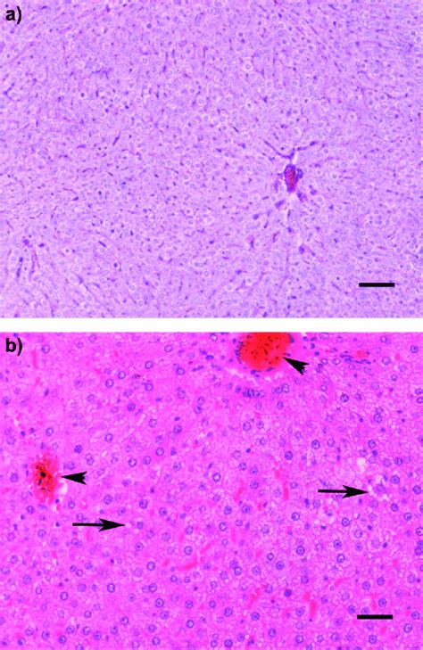 A Severe Widespread Liver Lipidosis In The Rat Livers Of The Diabetic Download Scientific