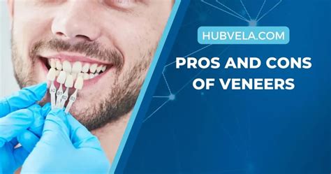 10+ Pros and Cons of Veneers » Hubvela