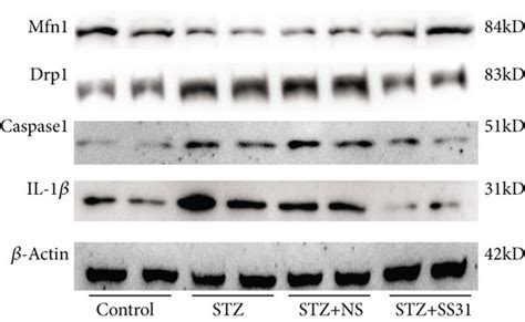 Renal Il 1β Caspase1 Mfn1 And Drp1 Expression In Diabetic Mice