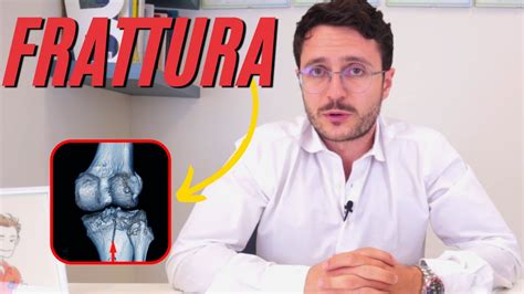 Frattura Piatto Tibiale Trattamenti Possibili E Riabilitazione YouTube