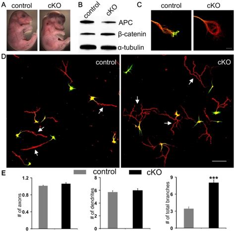 A Control Left And APC CKO Mouse Embryos Right At E16 5 B