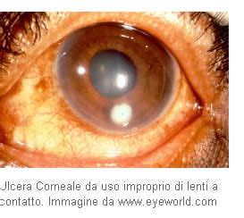 Cornea My Personaltrainer It