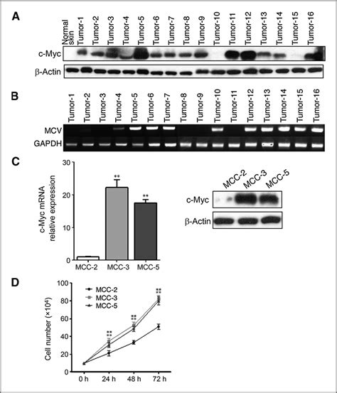 C Myc Protein Expression In Mcc Fresh Tumors And Primary Cell Lines A