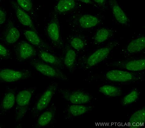 Dusp11 Antibody Cl488 10204 Proteintech 武汉三鹰生物技术有限公司