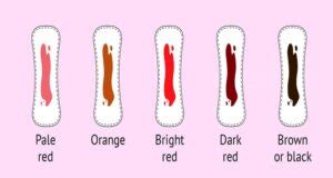 Menstrual Blood Color What It Means