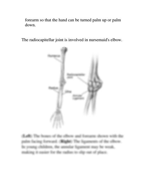 SOLUTION: 12 pulled elbow - Studypool