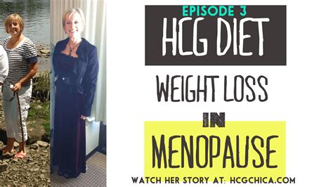 Hcg Diet Interviews Episode 3 50lb Weight Loss Even While In Menopause