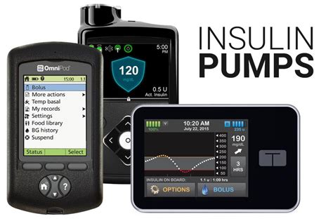 Insulin Pumps Types