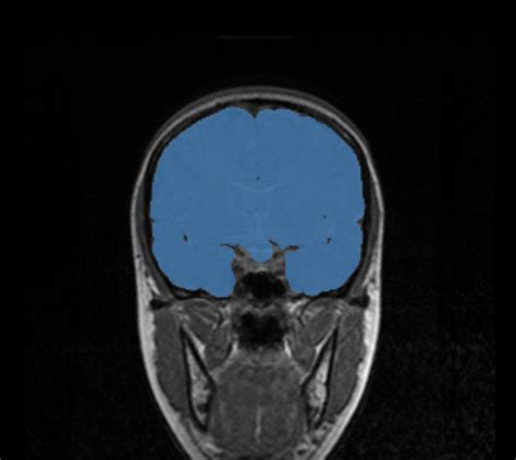 Previous Projects Magnetic Resonance Research Facility Carver