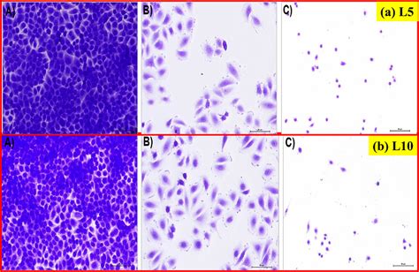 Comparative In Vitro Anticancer Study Of Cisplatin Drug With Green