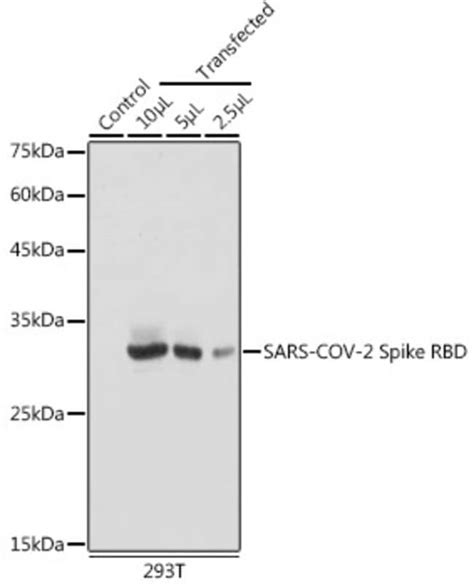 Sars Cov Spike Protein Rbd Mouse Anti Virus Clone Nan Invitrogen