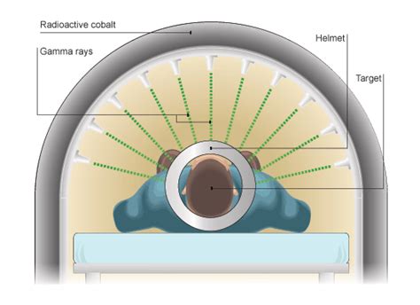 How Can Gamma Rays Treat Cancer Cancerwalls