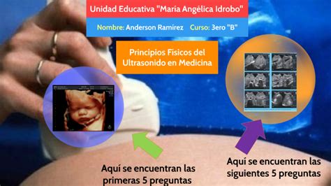 Principios F Sicos Del Ultrasonido En Medicina By Anderson Ram Rez On Prezi