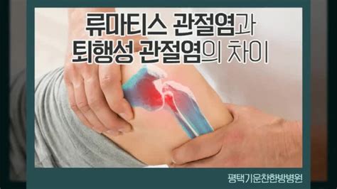 오성한방병원 류마티스 관절염과 퇴행성 관절염 네이버 블로그