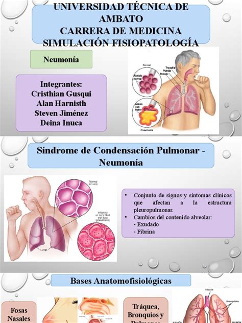 Fisiopatología De La Neumonía Pdf Pulmón Neumonía