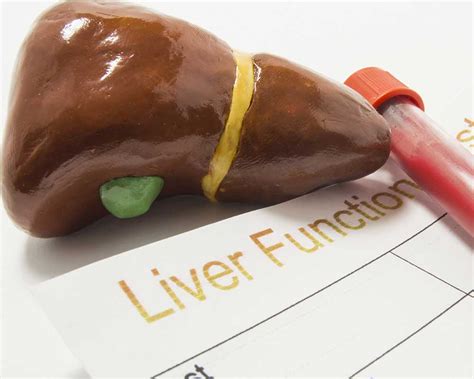 How Can You Lower Liver Enzymes Naturally? - Fatty Liver Disease