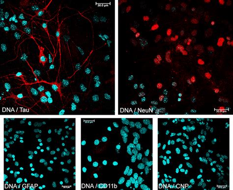 Phenotyping Of Primary Culture Of Murine Neurons Immunofluorescence