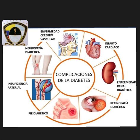 Complicaciones De La Diabetes Tipo 2