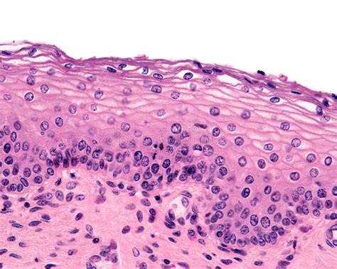 Vagina Stratified Aquamous Epithelium Stock Image Image Of Squamous