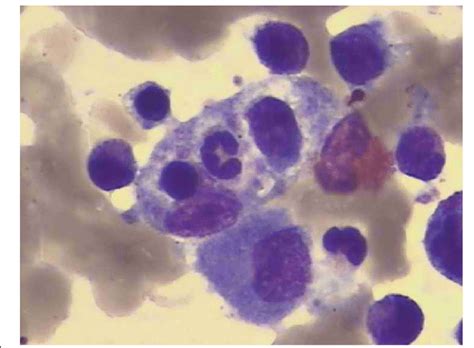 Bone marrow macrophage phagocytosis | Download Scientific Diagram